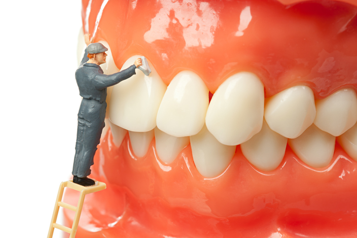 cleaning your dental implants